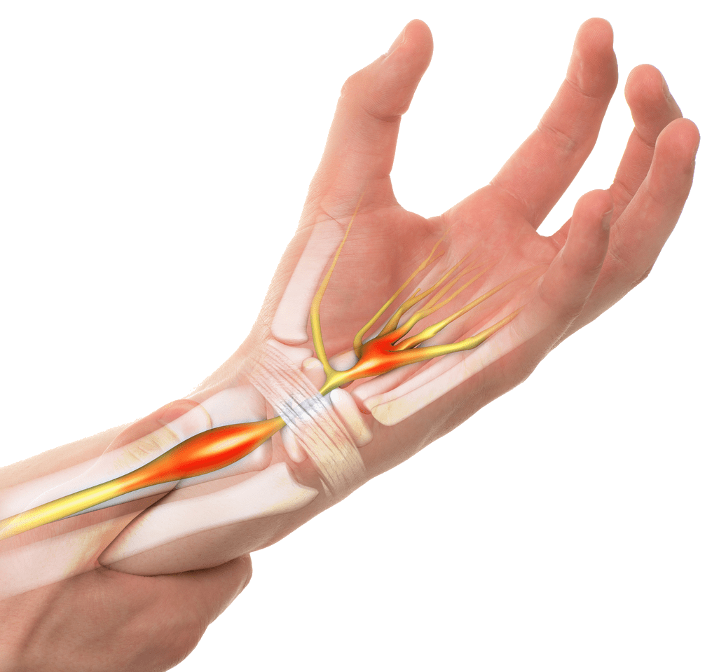 Orthopaedic & Trauma Surgeon Wrist Carpal tunnel syndrome